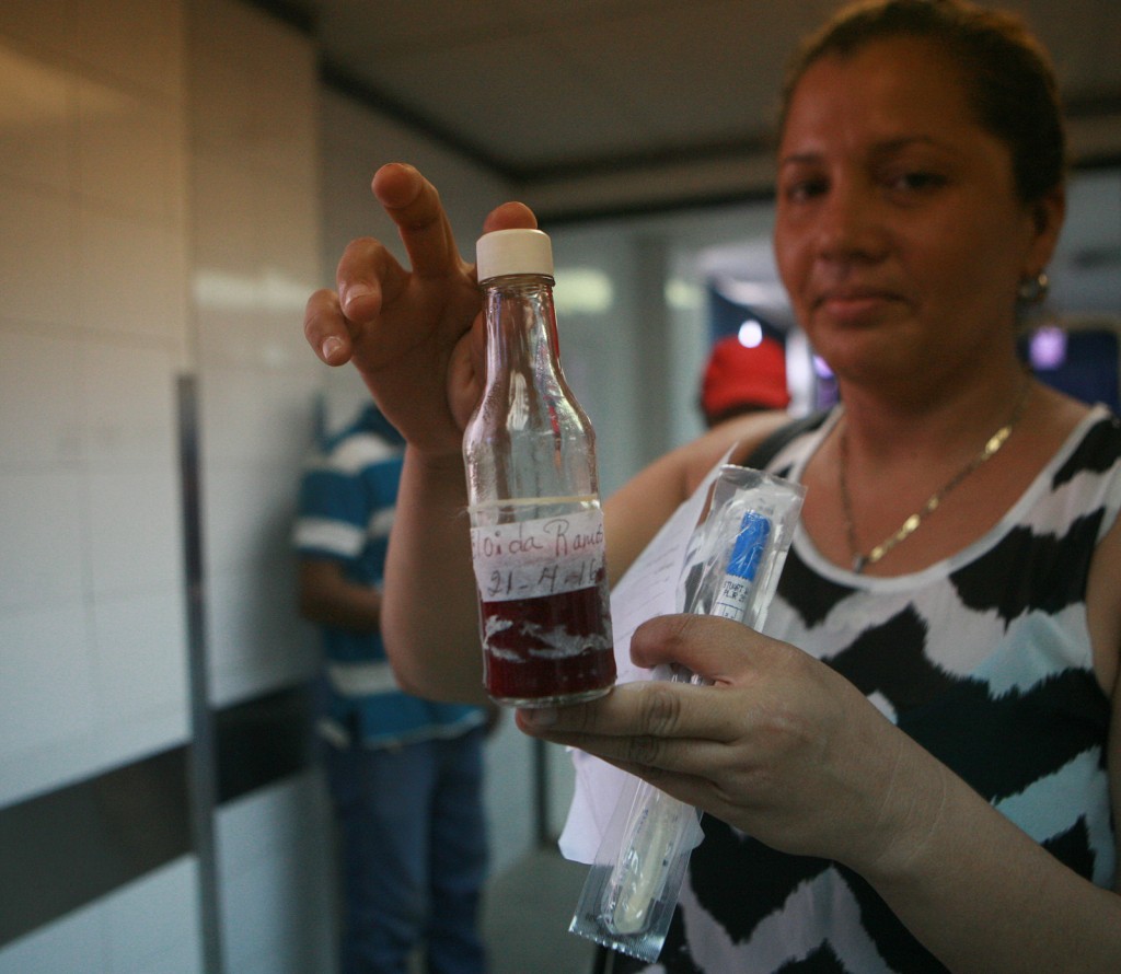 No hay depósitos para las muestras de sangre.